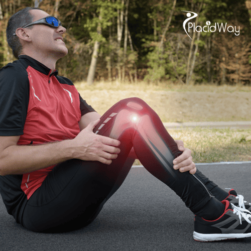 Total Knee Replacement in Turkey: A UK Patient's Guide to Surgery and Rehab